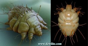 Treatment of scabies, is scabies contagious, prevention of scabies, scabies drug,